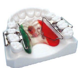 First Class Molar Distalizer leone