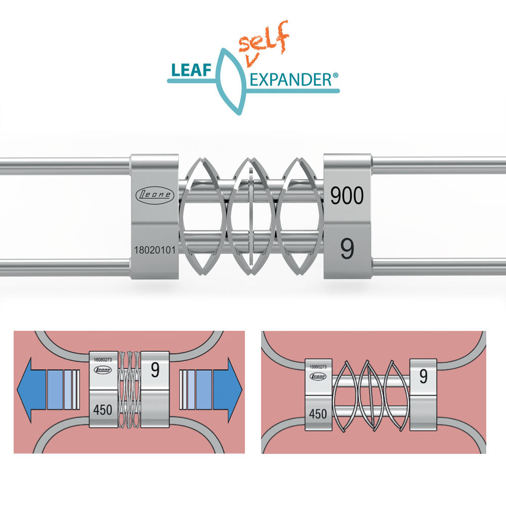 Leaf Expander leone