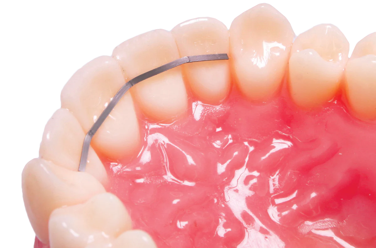 Dead Soft Retention Wire Orthoclassic