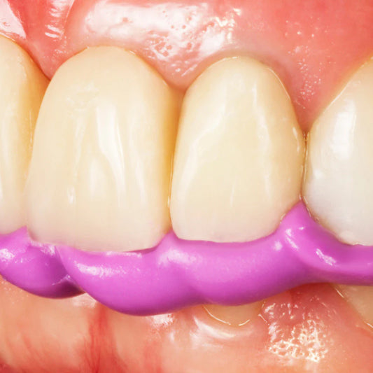 Occlufast Rock - Bite Registration A-Silicone ZHERMACK