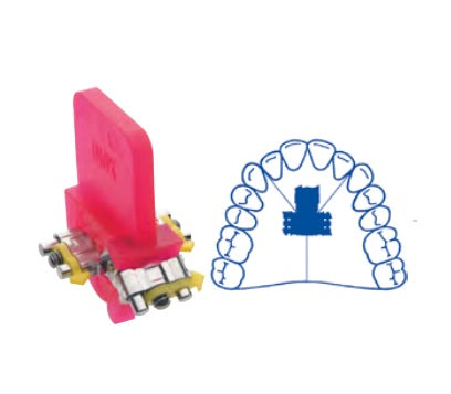 Three directional Anatomical Screw leone