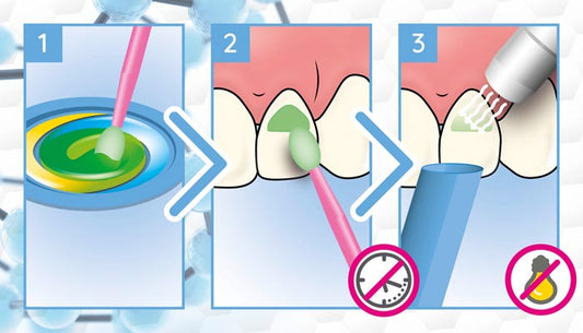 Universal Bond II Tokuyama