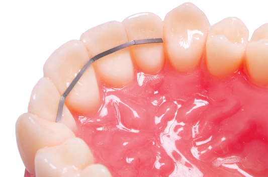 Dead Soft Retention Wire Orthoclassic