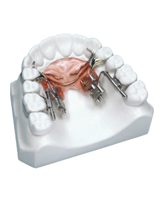 Fast Back Molar Distalizer leone