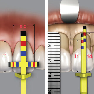 Chu`s Gauges